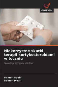Niekorzystne skutki terapii kortykosteroidami w toczniu