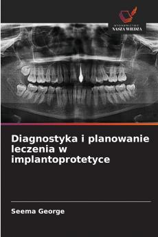 Diagnostyka i planowanie leczenia w implantoprotetyce
