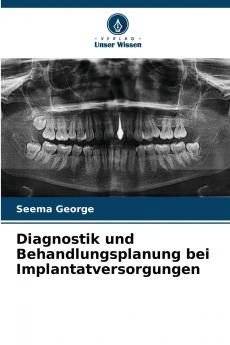 Diagnostik und Behandlungsplanung bei Implantatversorgungen