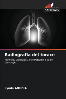 Radiografia del torace