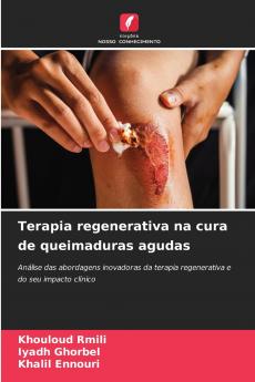 Terapia regenerativa na cura de queimaduras agudas