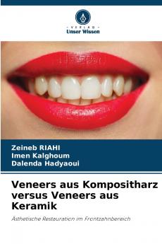 Veneers aus Kompositharz versus Veneers aus Keramik