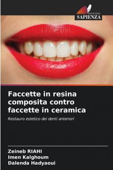 Faccette in resina composita contro faccette in ceramica