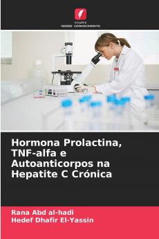 Hormona Prolactina TNF-alfa e Autoanticorpos na Hepatite C Crónica