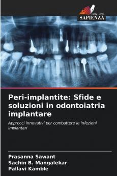Peri-implantite
