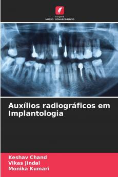 Auxílios radiográficos em Implantologia