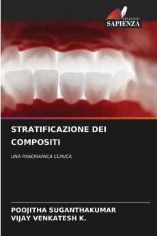STRATIFICAZIONE DEI COMPOSITI