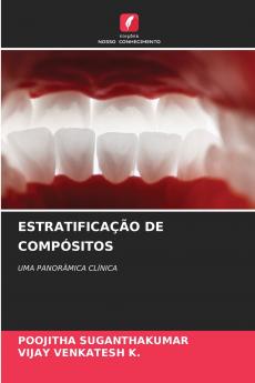 ESTRATIFICAÇÃO DE COMPÓSITOS