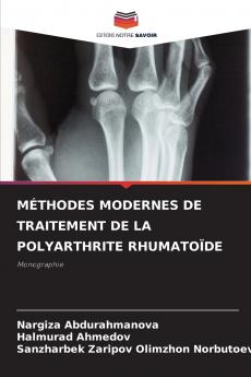 MÉTHODES MODERNES DE TRAITEMENT DE LA POLYARTHRITE RHUMATOÏDE