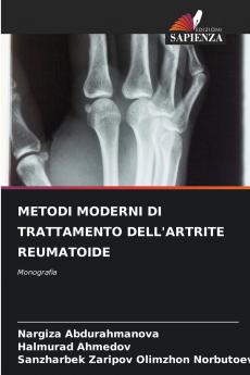 METODI MODERNI DI TRATTAMENTO DELL'ARTRITE REUMATOIDE