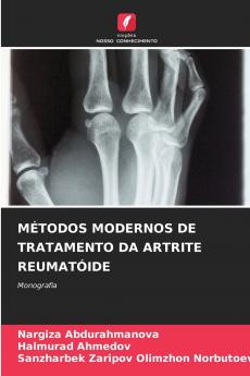 MÉTODOS MODERNOS DE TRATAMENTO DA ARTRITE REUMATÓIDE