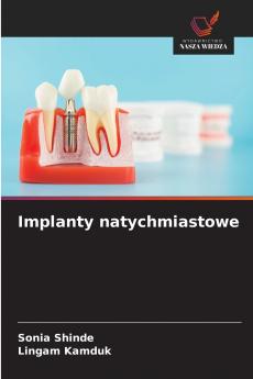 Implanty natychmiastowe