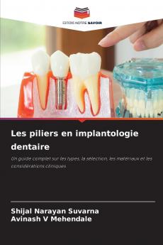 Les piliers en implantologie dentaire