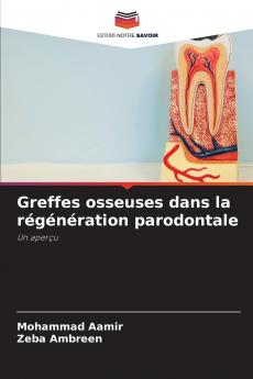 Greffes osseuses dans la régénération parodontale
