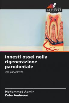 Innesti ossei nella rigenerazione parodontale