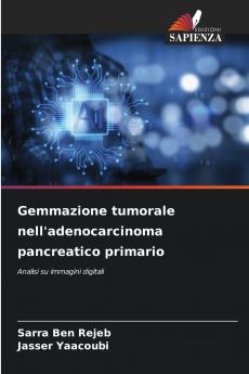 Gemmazione tumorale nell'adenocarcinoma pancreatico primario