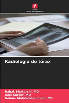 Radiologia do tórax