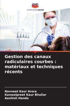 Gestion des canaux radiculaires courbes