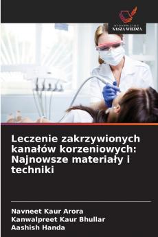 Leczenie zakrzywionych kanałów korzeniowych