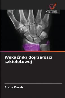 Wskaźniki dojrzałości szkieletowej