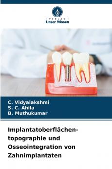 Implantatoberflächen- topographie und Osseointegration von Zahnimplantaten