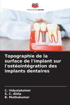 Topographie de la surface de l'implant sur l'ostéointégration des implants dentaires