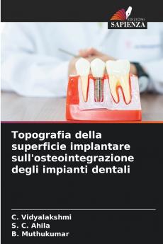 Topografia della superficie implantare sull'osteointegrazione degli impianti dentali
