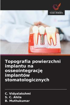 Topografia powierzchni implantu na osseointegrację implantów stomatologicznych