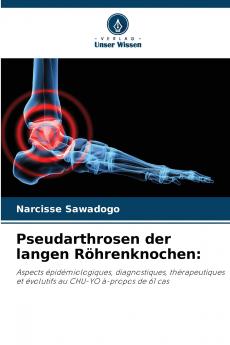 Pseudarthrosen der langen Röhrenknochen