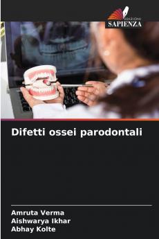 Difetti ossei parodontali