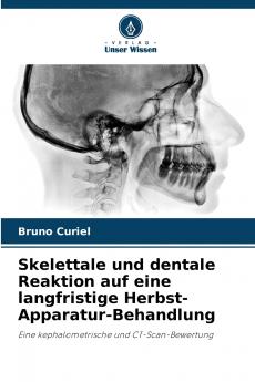 Skelettale und dentale Reaktion auf eine langfristige Herbst-Apparatur-Behandlung