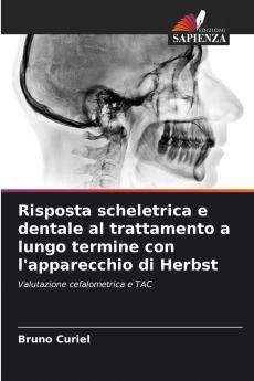 Risposta scheletrica e dentale al trattamento a lungo termine con l'apparecchio di Herbst