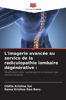 L'imagerie avancée au service de la radiculopathie lombaire dégénérative