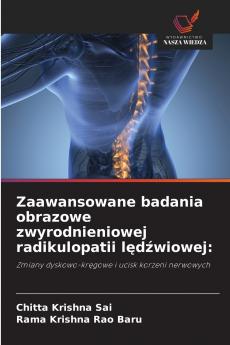 Zaawansowane badania obrazowe zwyrodnieniowej radikulopatii lędźwiowej