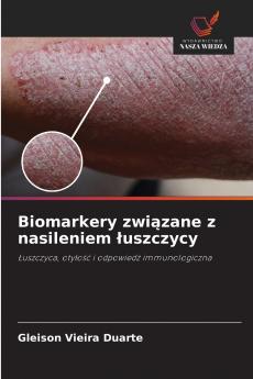 Biomarkery związane z nasileniem łuszczycy