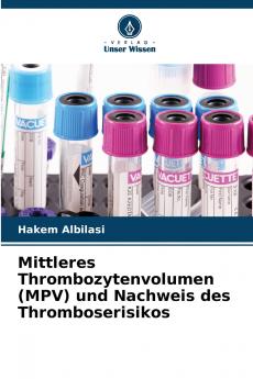 Mittleres Thrombozytenvolumen (MPV) und Nachweis des Thromboserisikos