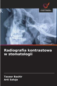 Radiografia kontrastowa w stomatologii