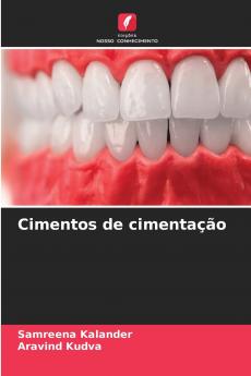 Cimentos de cimentação