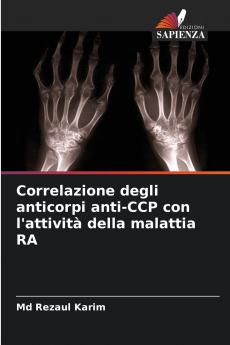 Correlazione degli anticorpi anti-CCP con l'attività della malattia RA