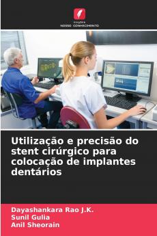 Utilização e precisão do stent cirúrgico para colocação de implantes dentários