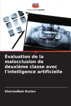 Évaluation de la malocclusion de deuxième classe avec l'intelligence artificielle