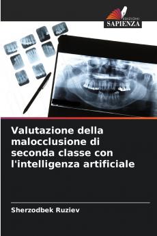 Valutazione della malocclusione di seconda classe con l'intelligenza artificiale