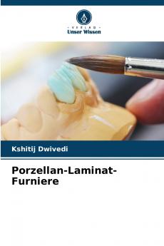 Porzellan-Laminat-Furniere