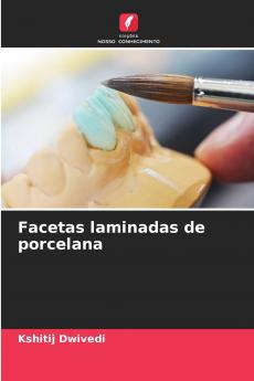 Facetas laminadas de porcelana