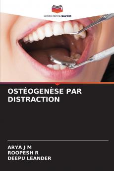 OSTÉOGENÈSE PAR DISTRACTION