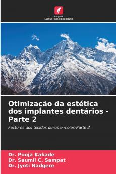 Otimização da estética dos implantes dentários - Parte 2