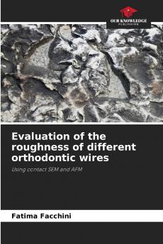 Evaluation of the roughness of different orthodontic wires