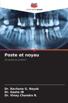 Poste et noyau