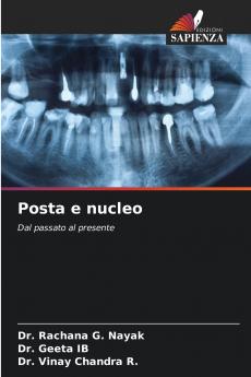 Posta e nucleo