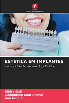 ESTÉTICA EM IMPLANTES